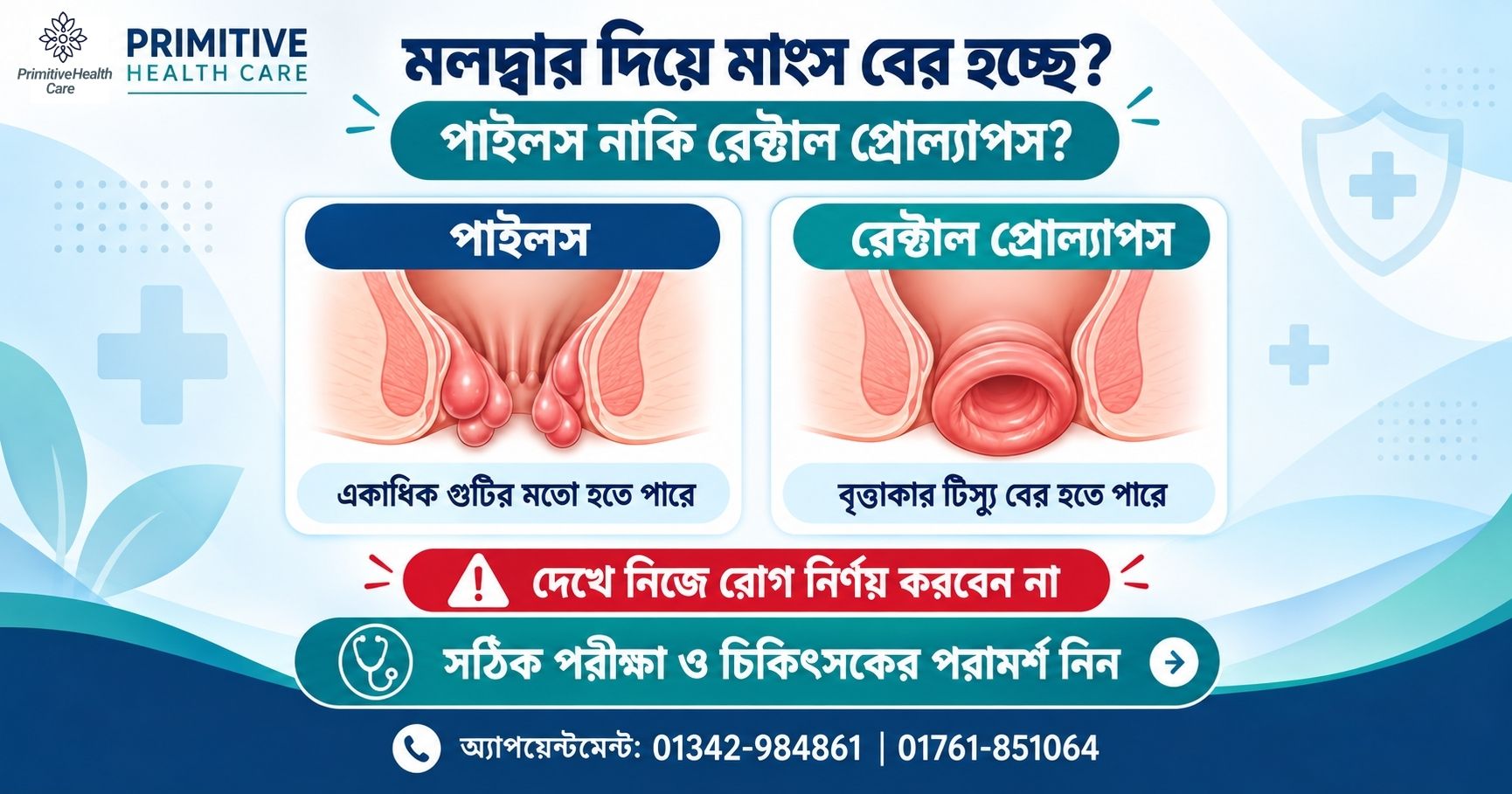 Piles Vs Rectal Prolapse Difference